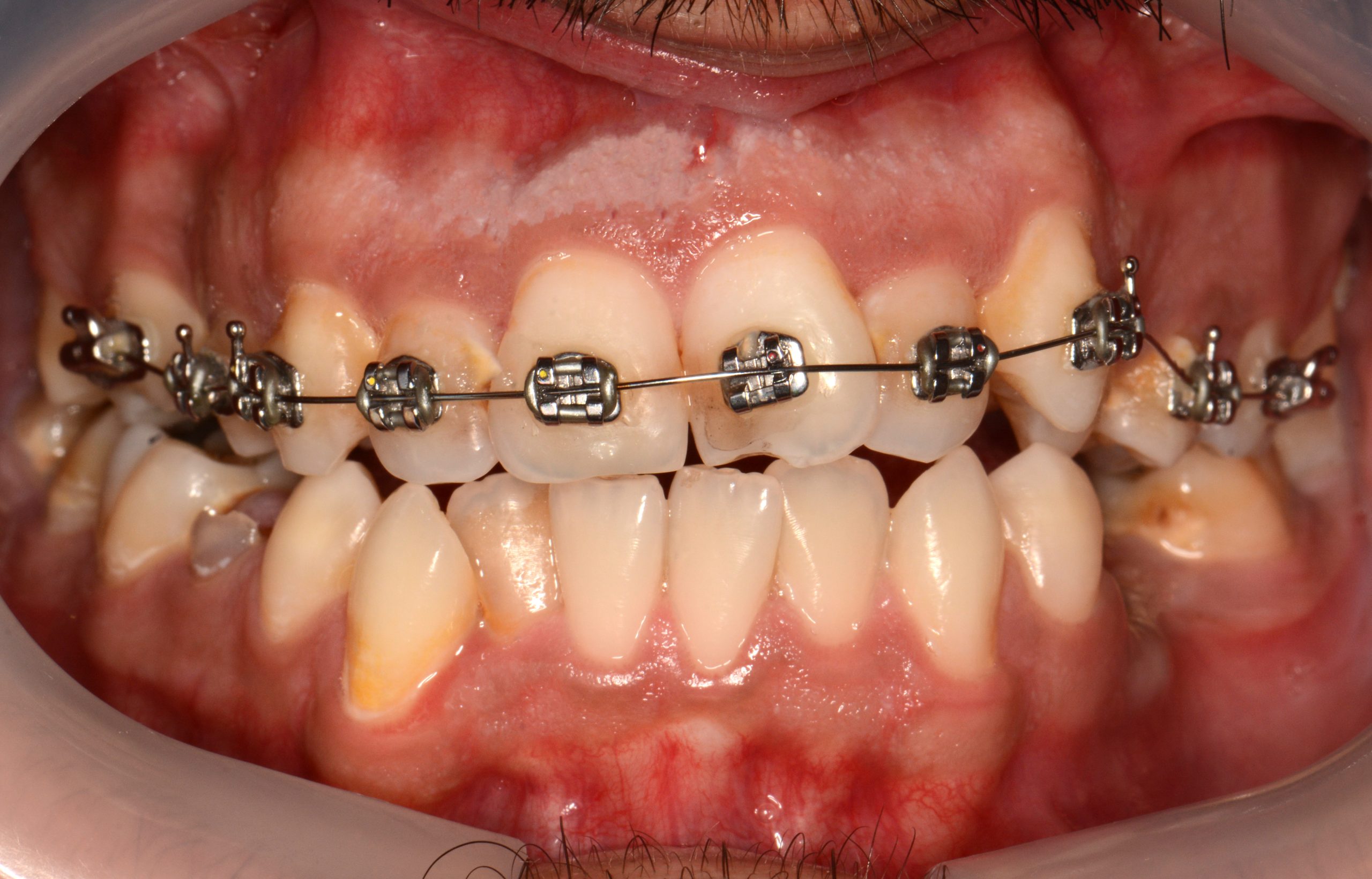 2023_05_06_22_56_IMG_0271