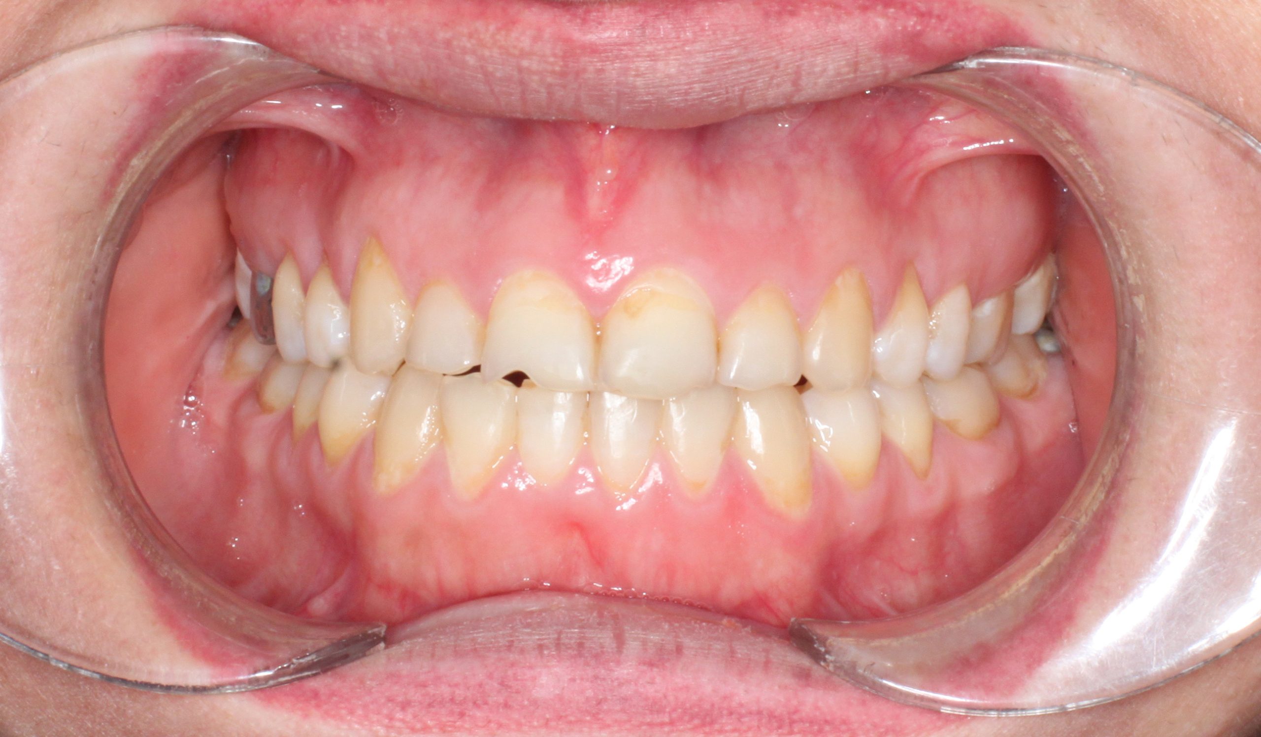 2023_05_06_23_09_IMG_0259