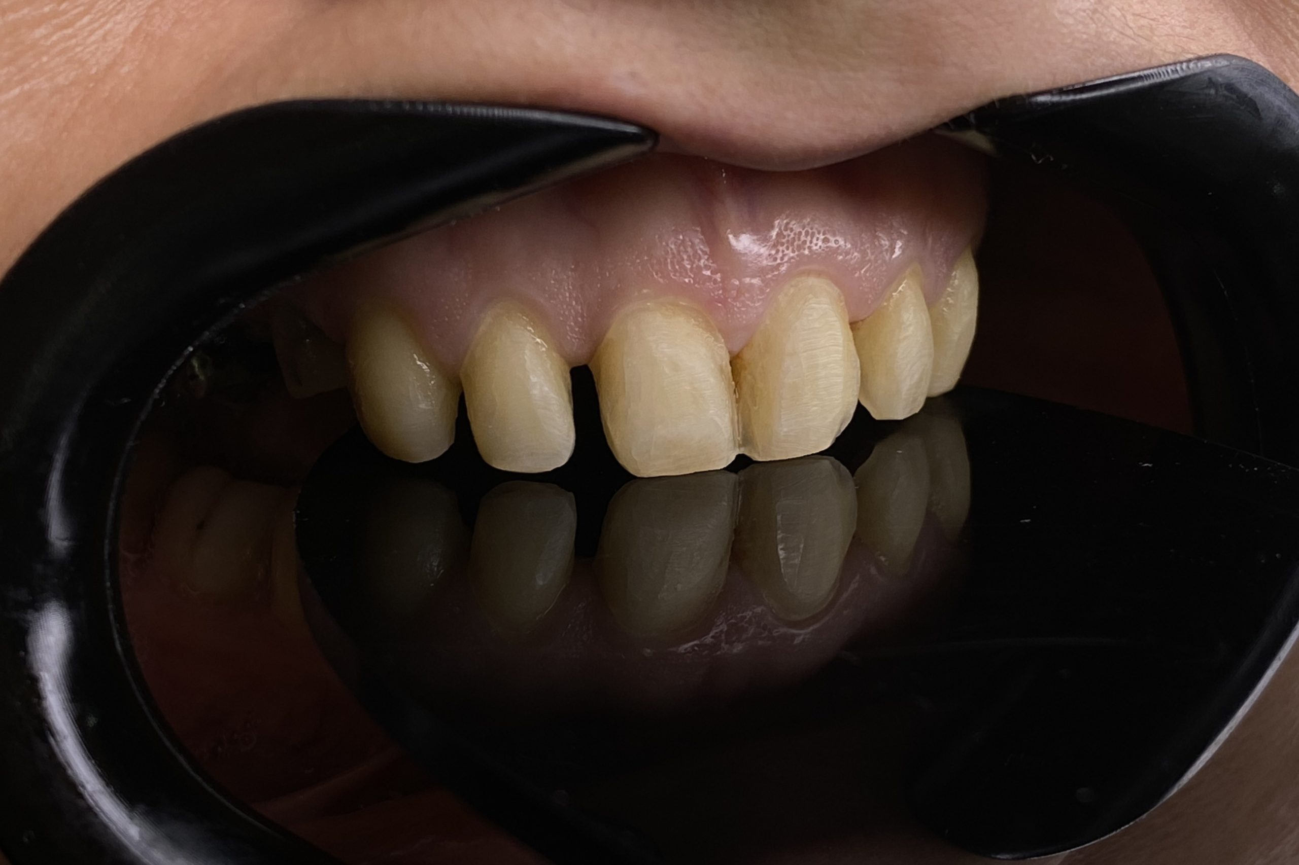 2024_11_16_19_19_IMG_2974co