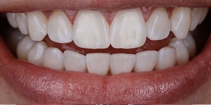 2025_05_09_20_53_IMG_0374