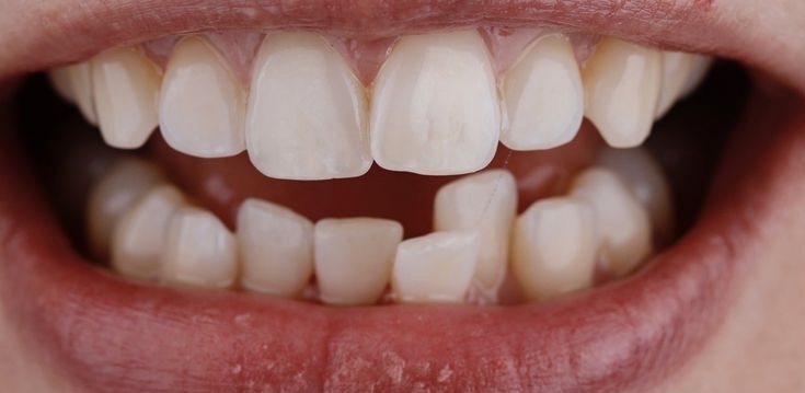 2025_05_09_20_53_IMG_0375