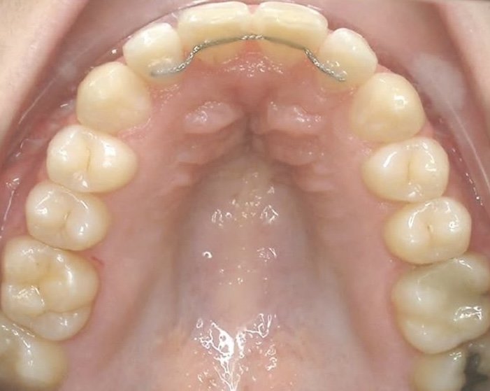 2025_05_09_20_54_IMG_0376