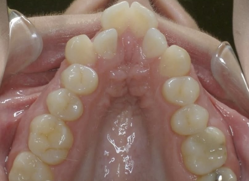 2025_05_09_20_56_IMG_0377