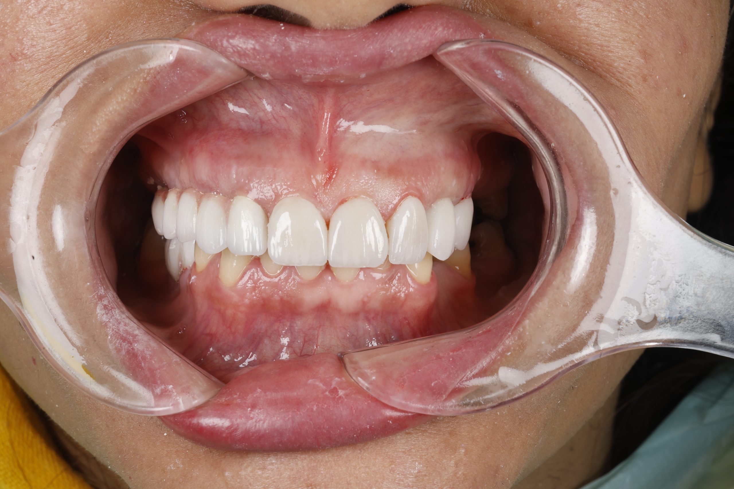 2025_07_12_18_44_IMG_2231