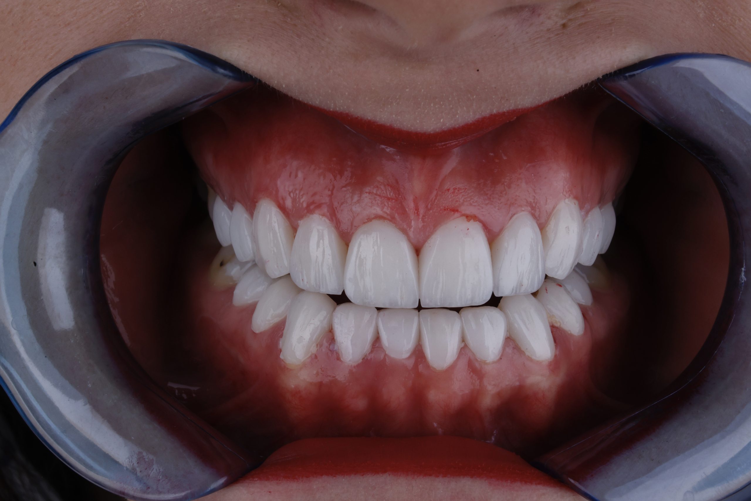 2025_08_23_19_04_IMG_3634