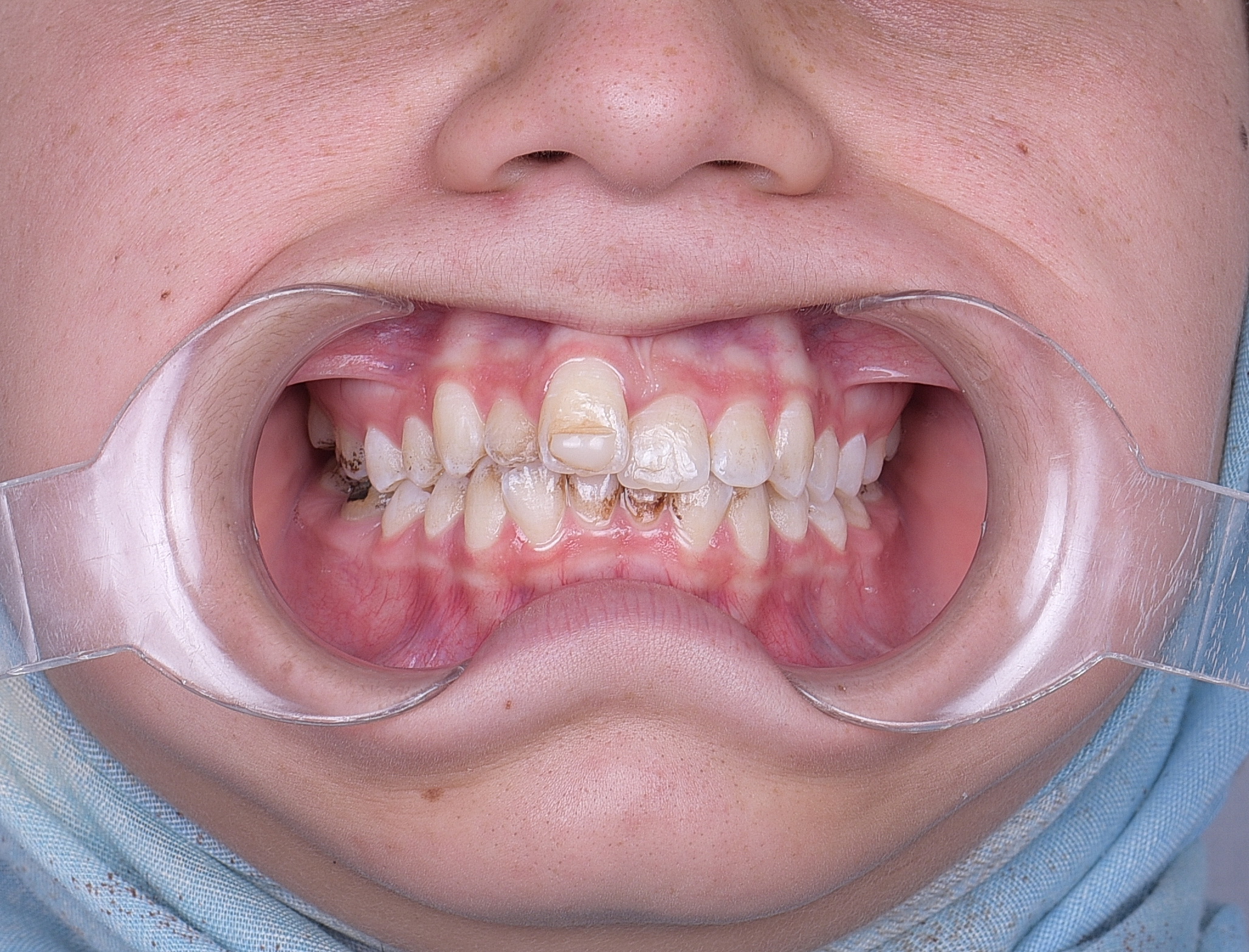 2021_11_07_11_09_IMG_0277