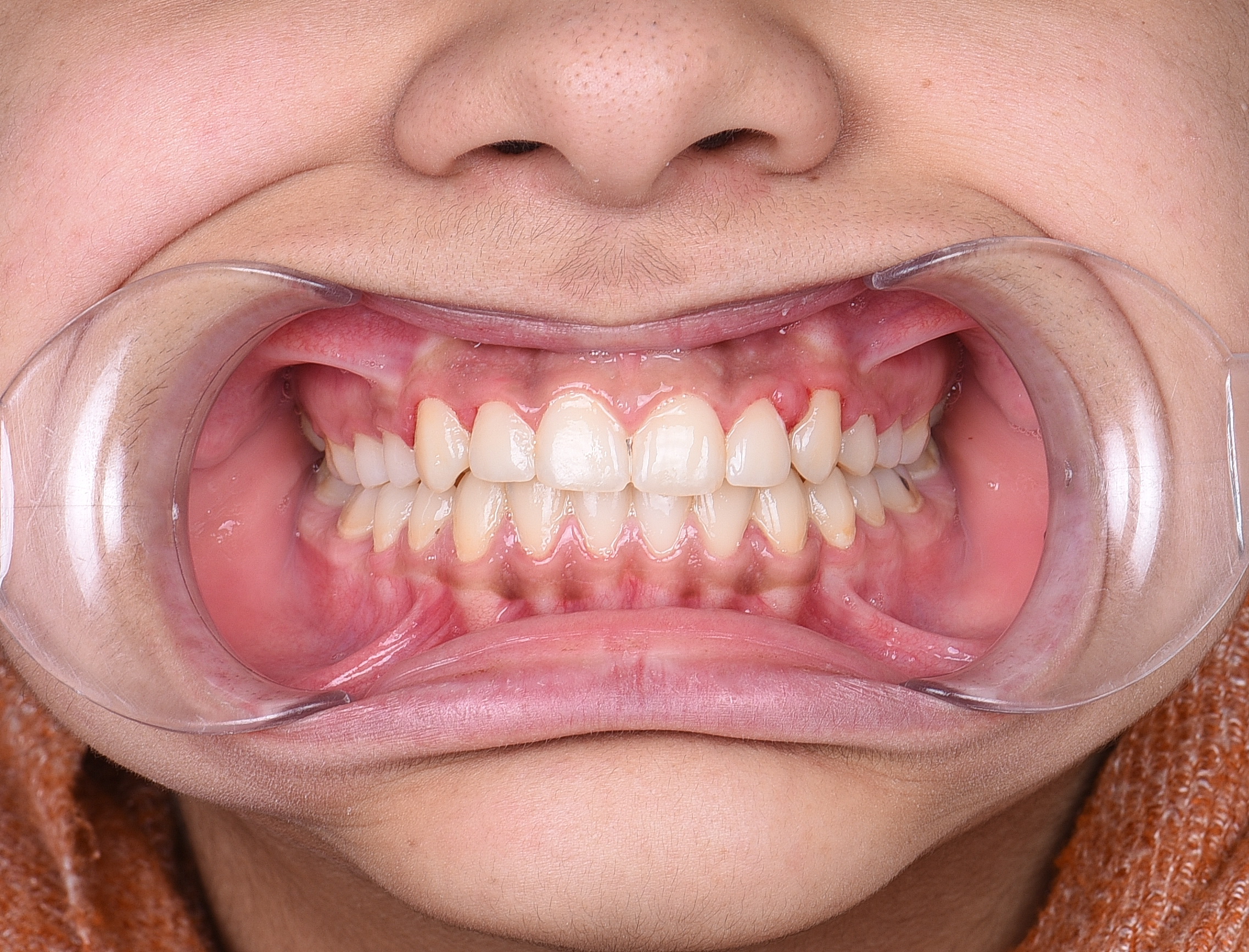 2023_02_04_15_25_IMG_0284