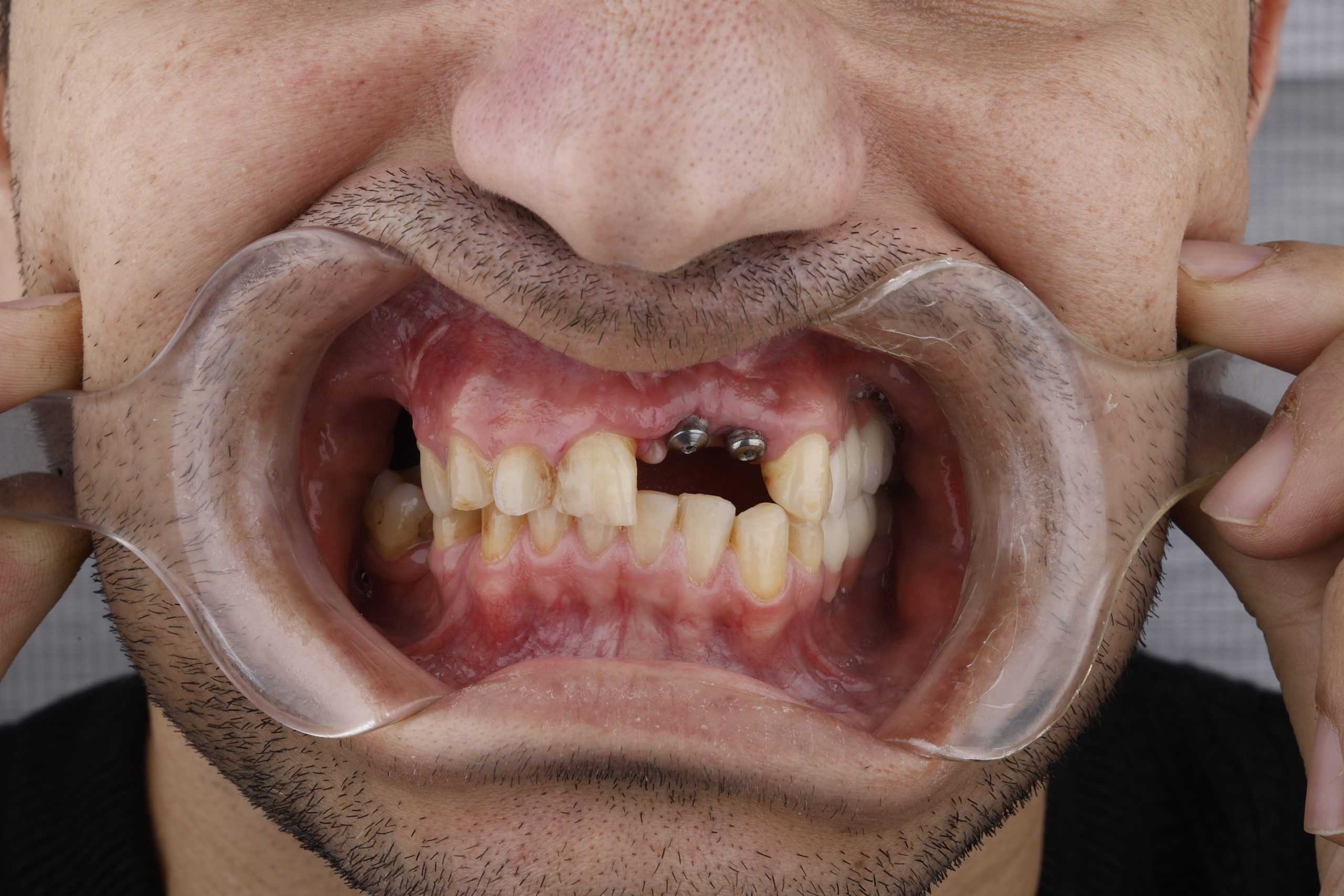 2025_01_15_19_07_IMG_1992