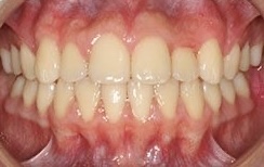 2025_05_09_20_53_IMG_0372