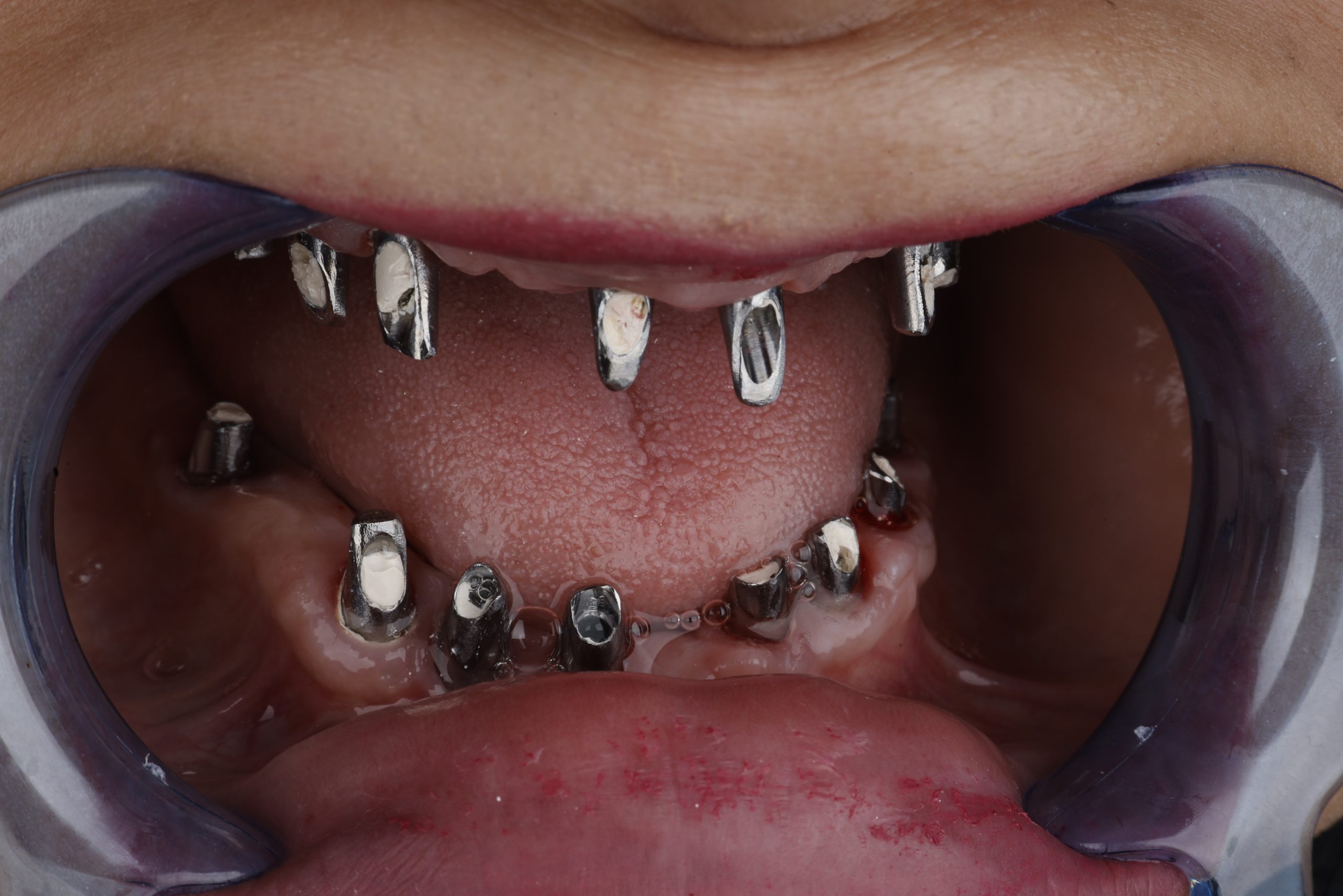 2025_07_02_17_49_IMG_4212