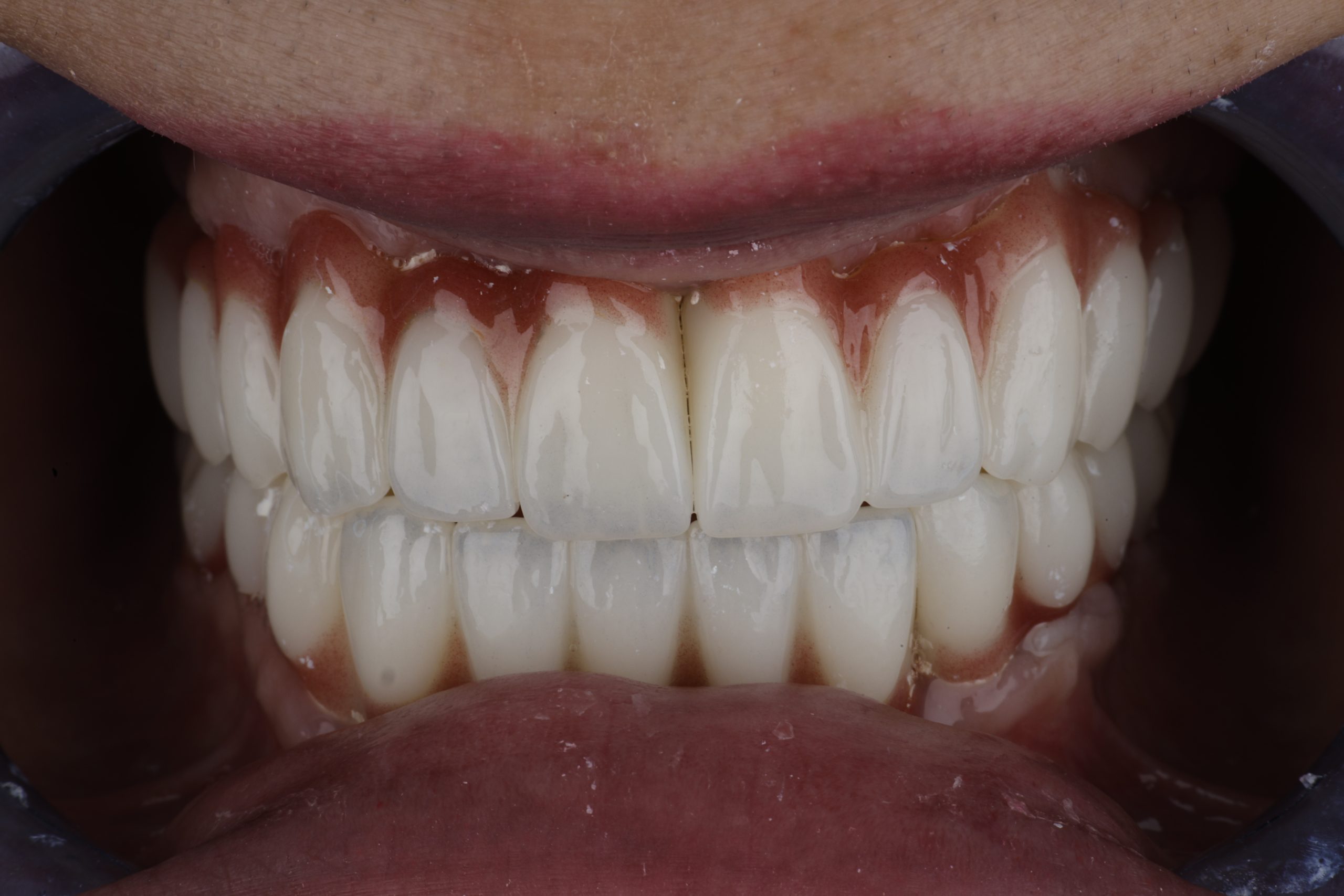 2025_07_02_18_15_IMG_1910