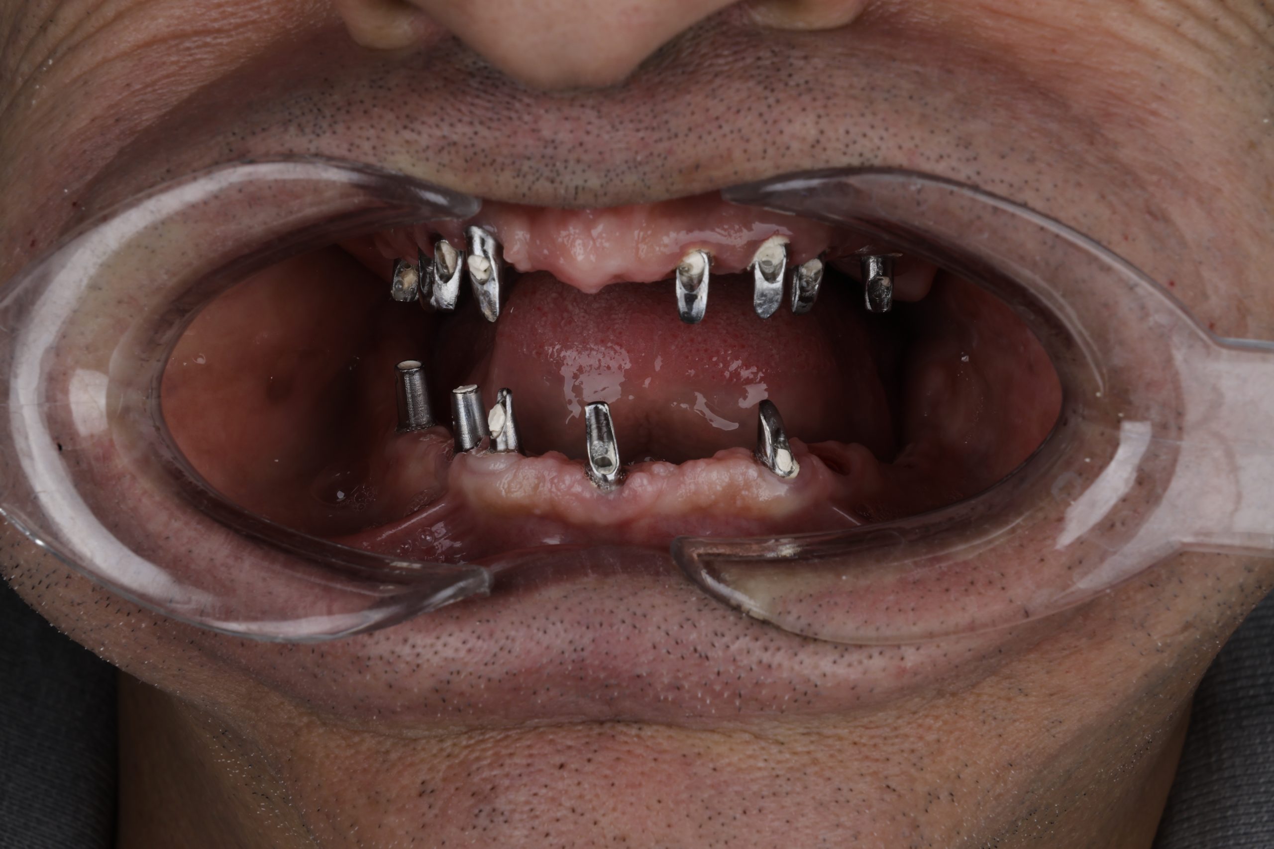 2025_07_28_14_50_IMG_2593