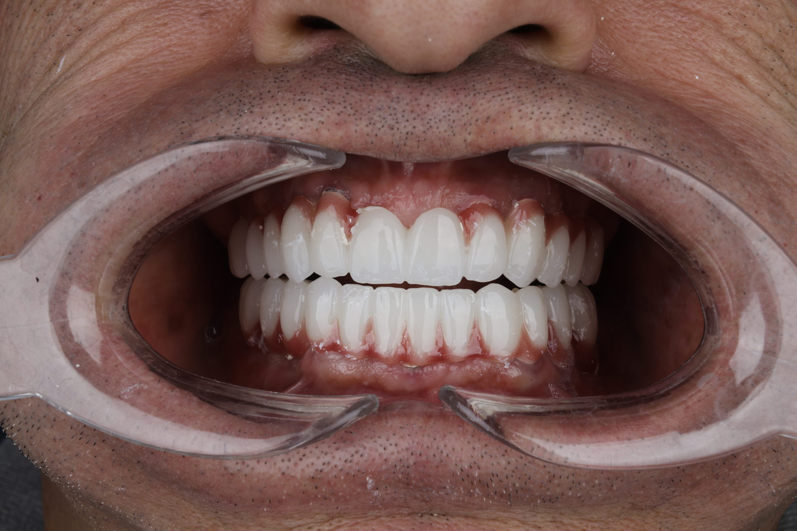 2025_07_28_15_45_IMG_2598