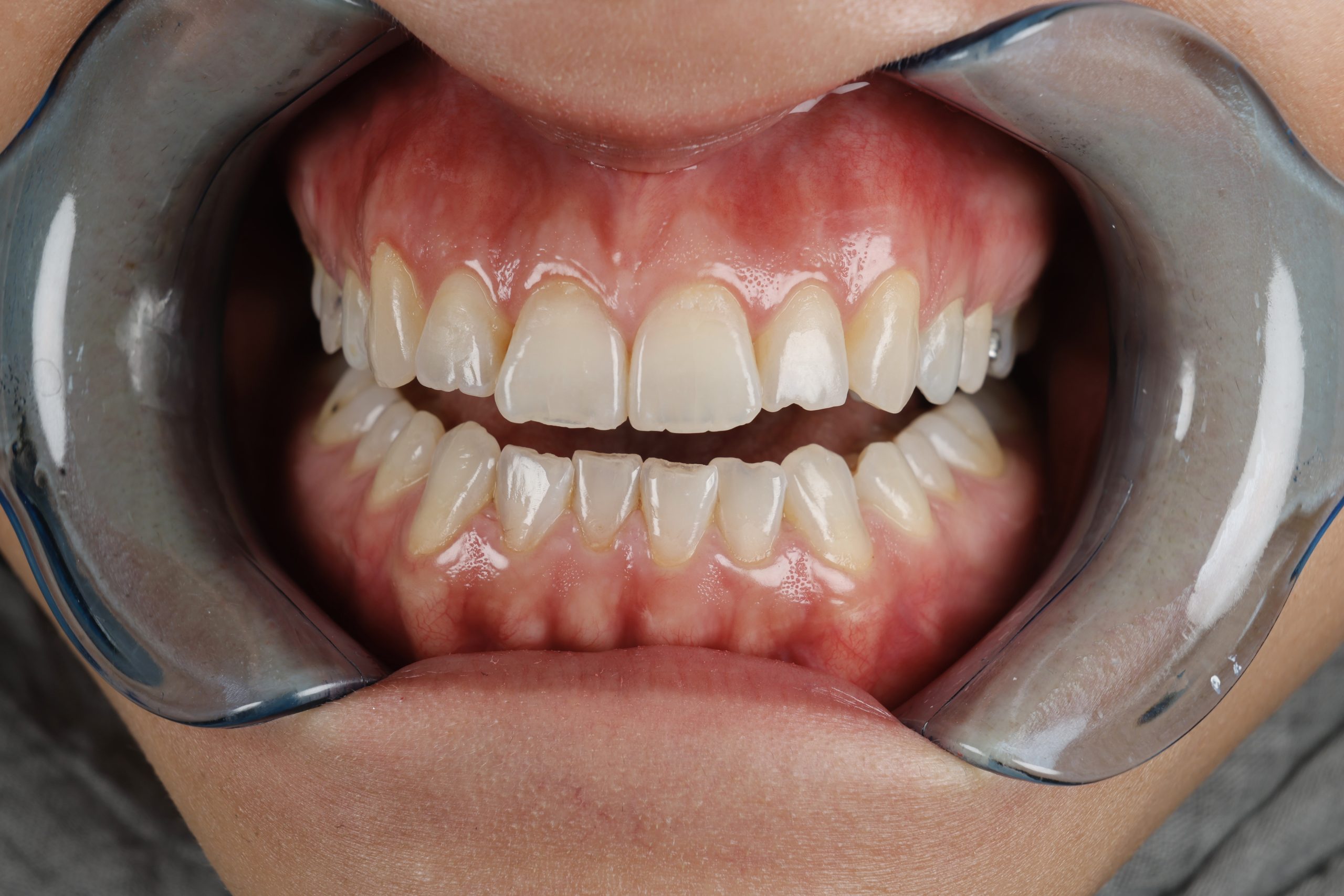 2025_08_12_10_13_IMG_3708