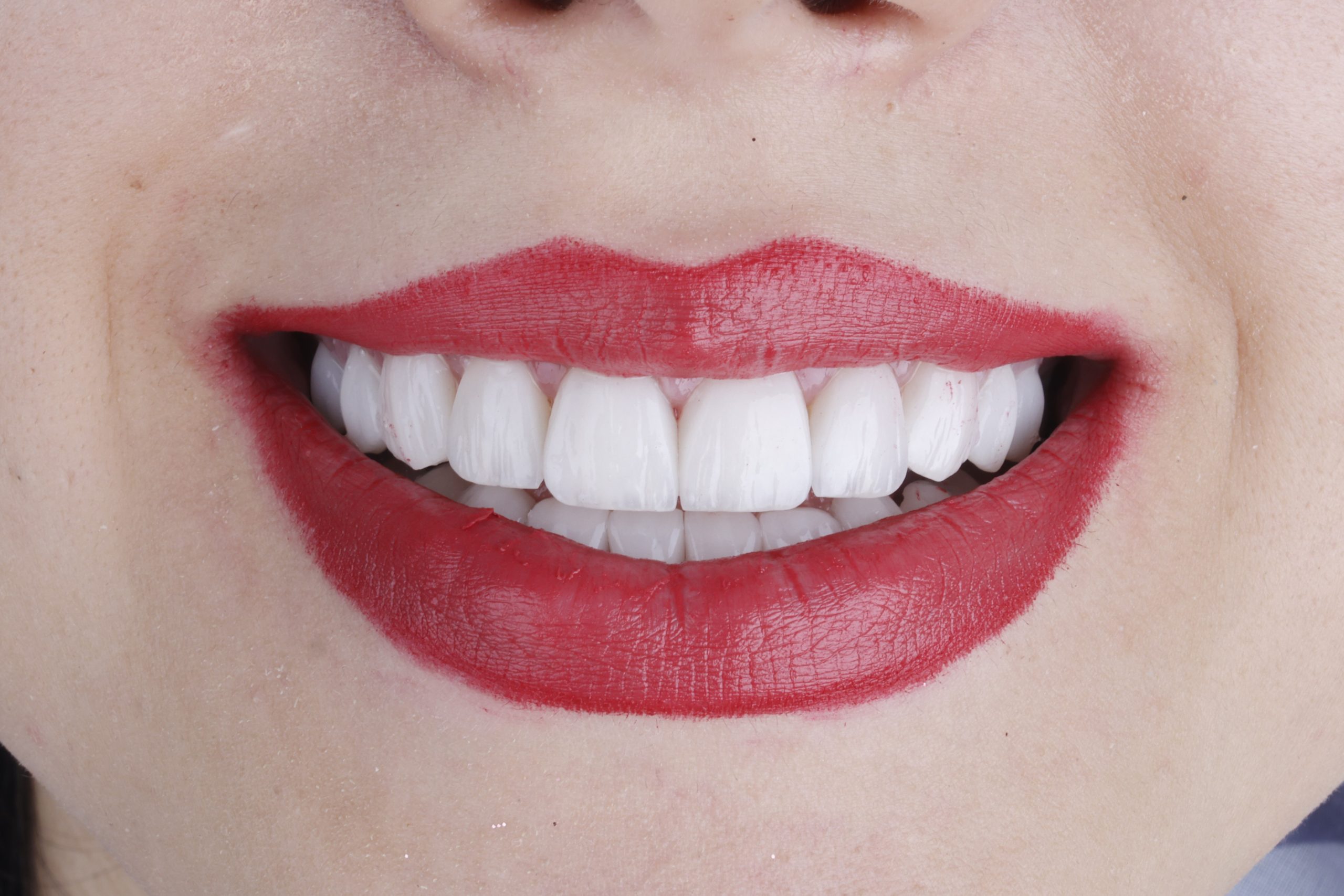 2025_08_23_18_59_IMG_3623